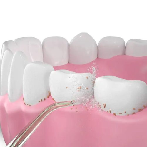 Oclean N10 Pink Irrigatorkopf – 2er-Pack, W10-kompatibel