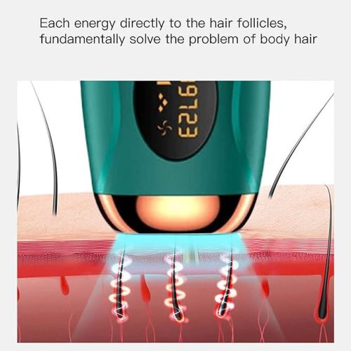 IPL-Haarentfernungsgerät für zu Hause (Smaragdgrün – Bronze)