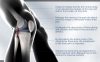 Rokesa Kniebandage, professionelle Schmerzlinderung mit Seitenstabilisatoren und Patella-Gel, Größe L (Türkisblau)